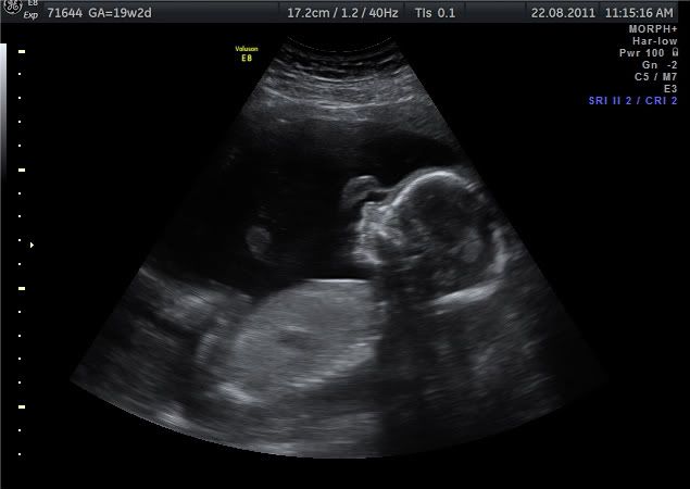 19w2d-our growing boy
